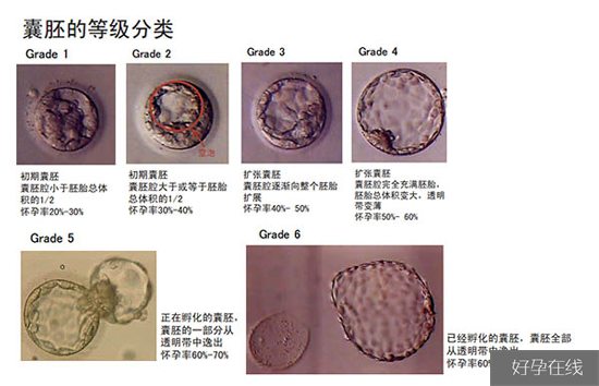 囊胚的等级分类